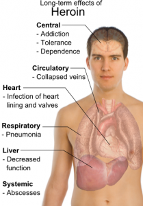 heroin effects