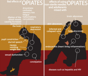 opiate side effects 