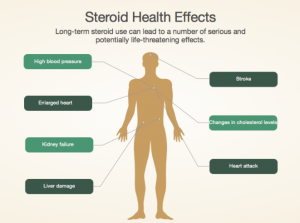 steroid effects